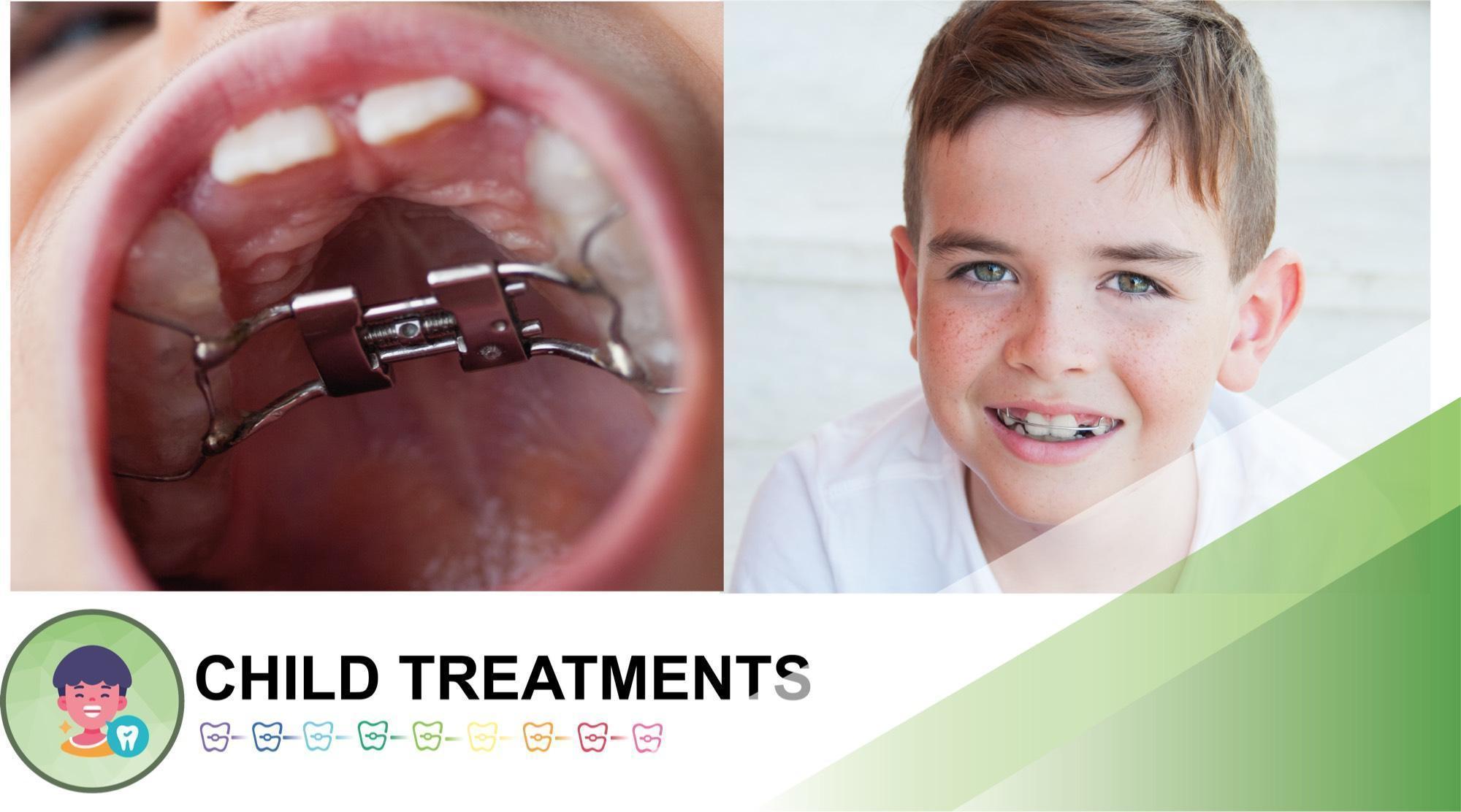 OrthoBoutique - a child smiling after child treatments