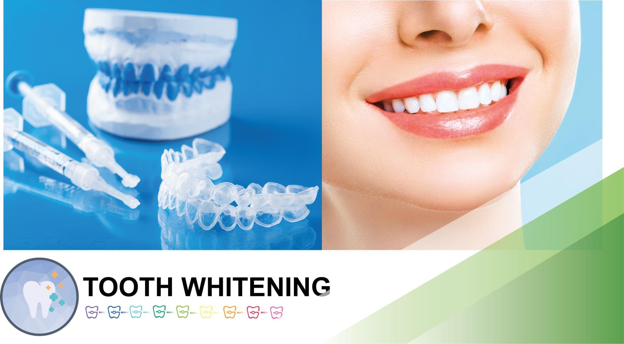 OrthoBoutique - tooth whitening