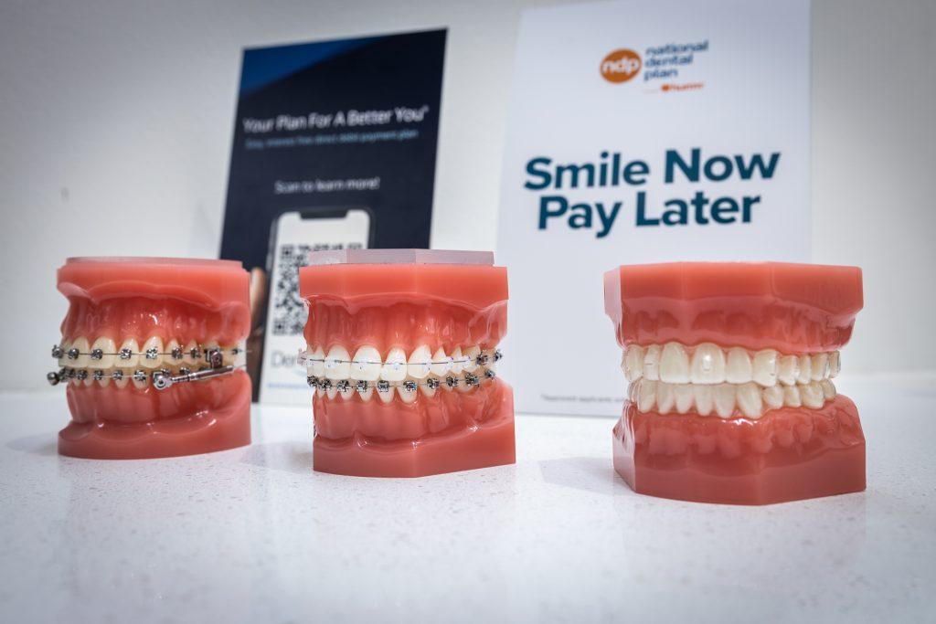 metal ceramic braces dental sydney